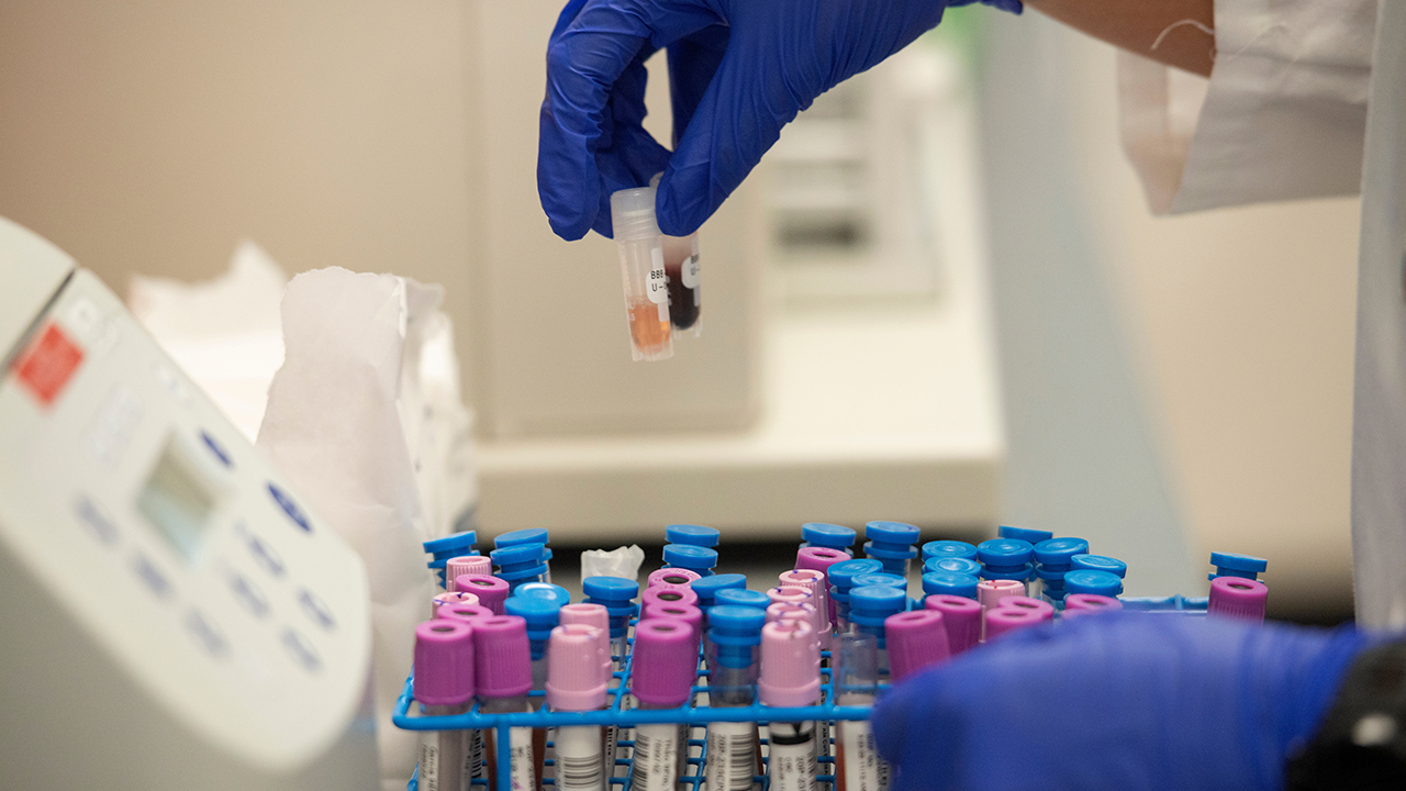 a blue-golves hand holds two small liquid samples over a tray of test tubes with blue, light pink and purple tops.